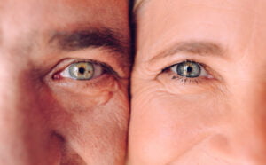 Can eyelid lift make dry eyes worse? What you need to know about dry eyes and blepharoplasty